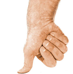Thumb.jpg